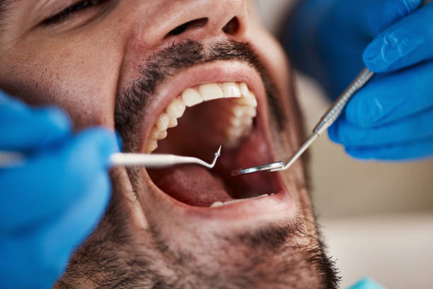 Best Emergency Dental Care for Sports Injuries in Watsonville, CA